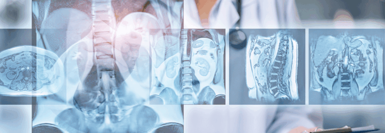 Top 10 Spine Doctors in Fortis Hospital India